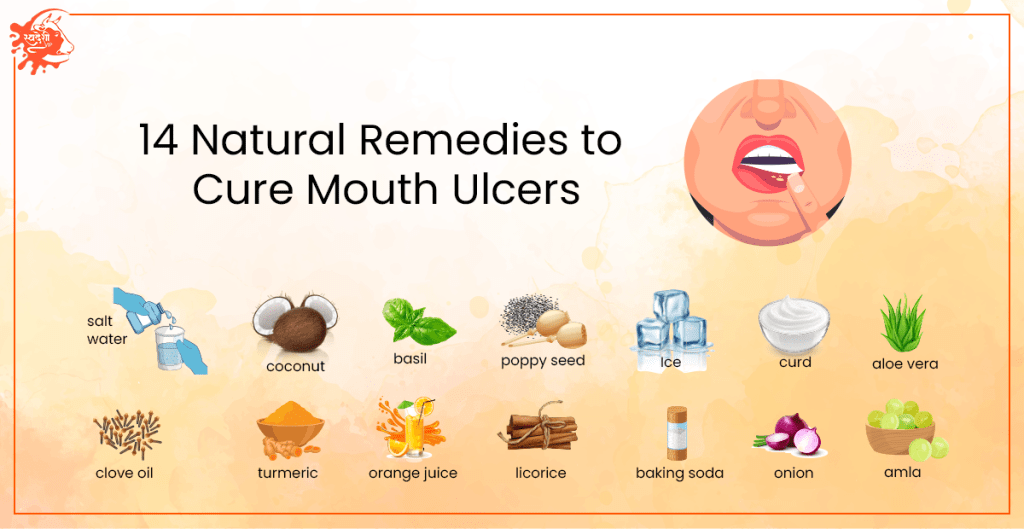 درمان خانگی آفت دهان