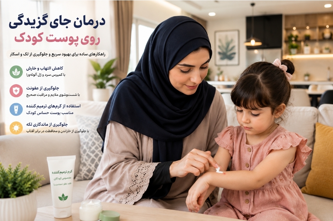 درمان خانگی گزیدگی و نیش حشرات